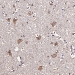 HECTD1 Antibody, Novus Biologicals 25 &mu;L | Buy Online | Novus Biologicals | Fisher Scientific